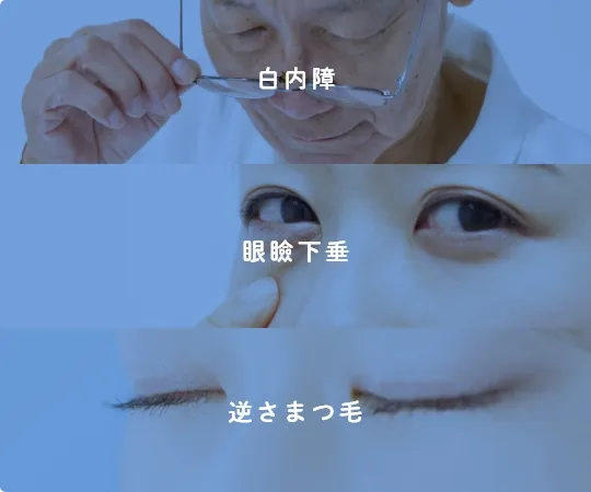 白内障