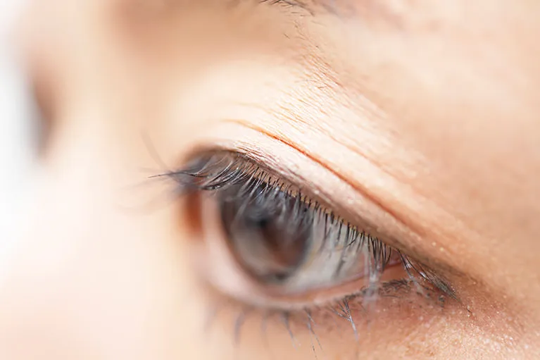 日帰り手術のメリット